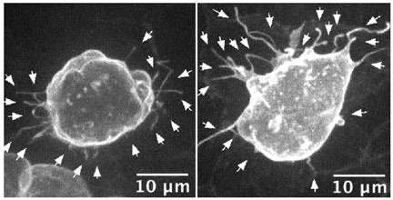 filopodia